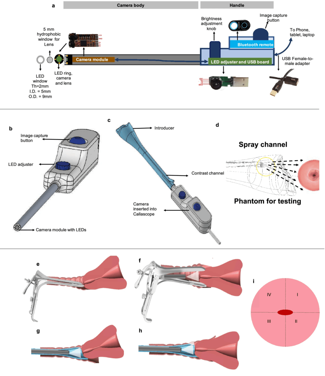 讓無數女性害怕的“鴨嘴鉗”，到底有沒有替代工具？